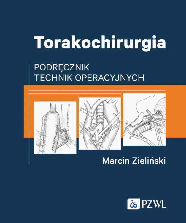 Torakochirurgia. Podręcznik technik operacyjnych