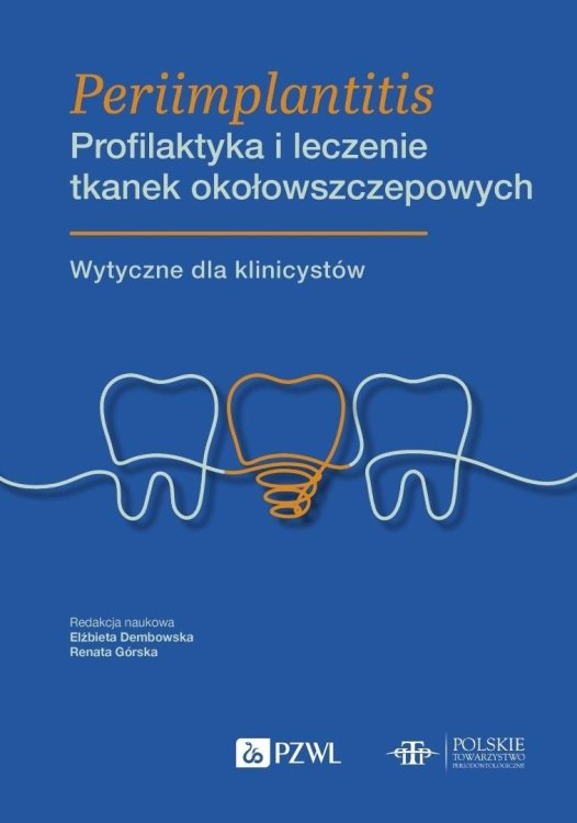 Periimplantitis. Profilaktyka i leczenie tkanek...