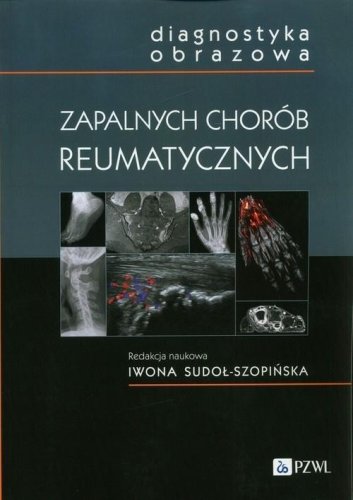 Diagnostyka obrazowa zapalnych chorób..