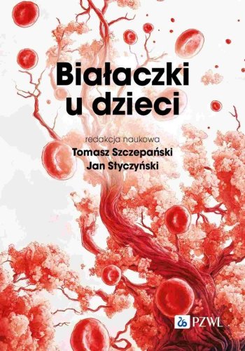 Białaczki u dzieci